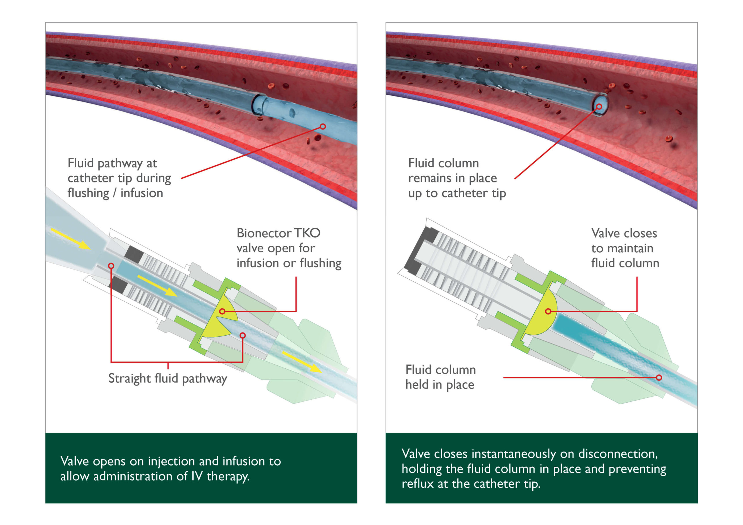 bi-directional-flow-diagram-2 How a TKO works