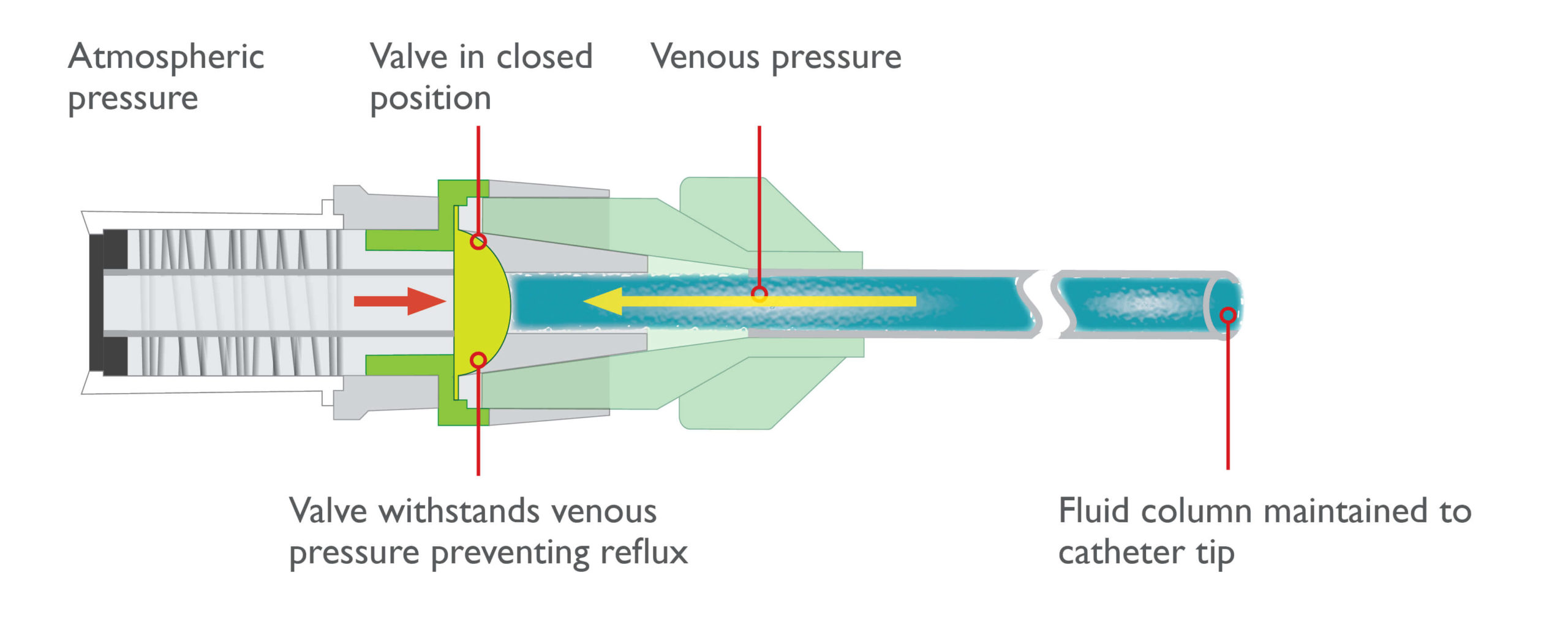 bi-directional-flow-diagram Inside a TKO