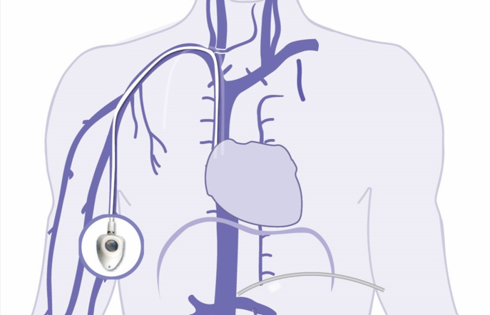 arm port